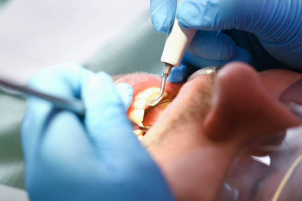 Best Broken or Chipped Tooth Repair in Inglis, FL