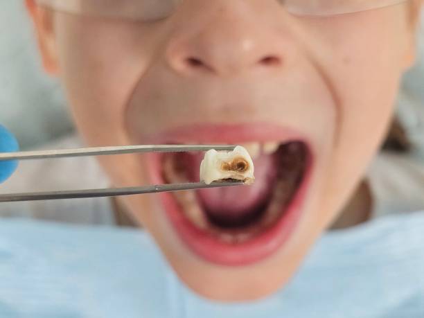 Best Emergency Care for Gum Disease in Inglis, FL